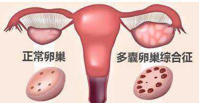 广州有谁做过助孕，广州有没有正规精子库医院？广州有精子库吗？
